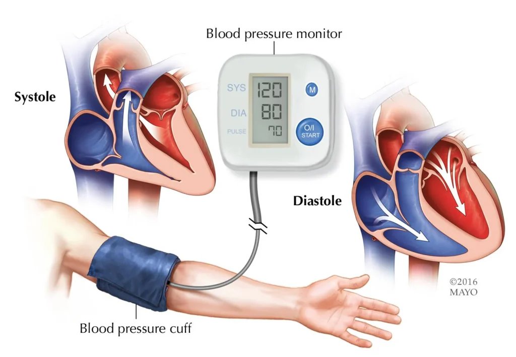 Scuba diving for people with high blood pressure